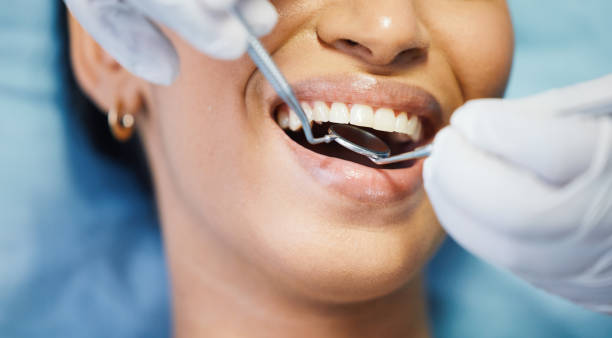 Best After-Hours Emergency Dentist in Wild Peach Village, TX